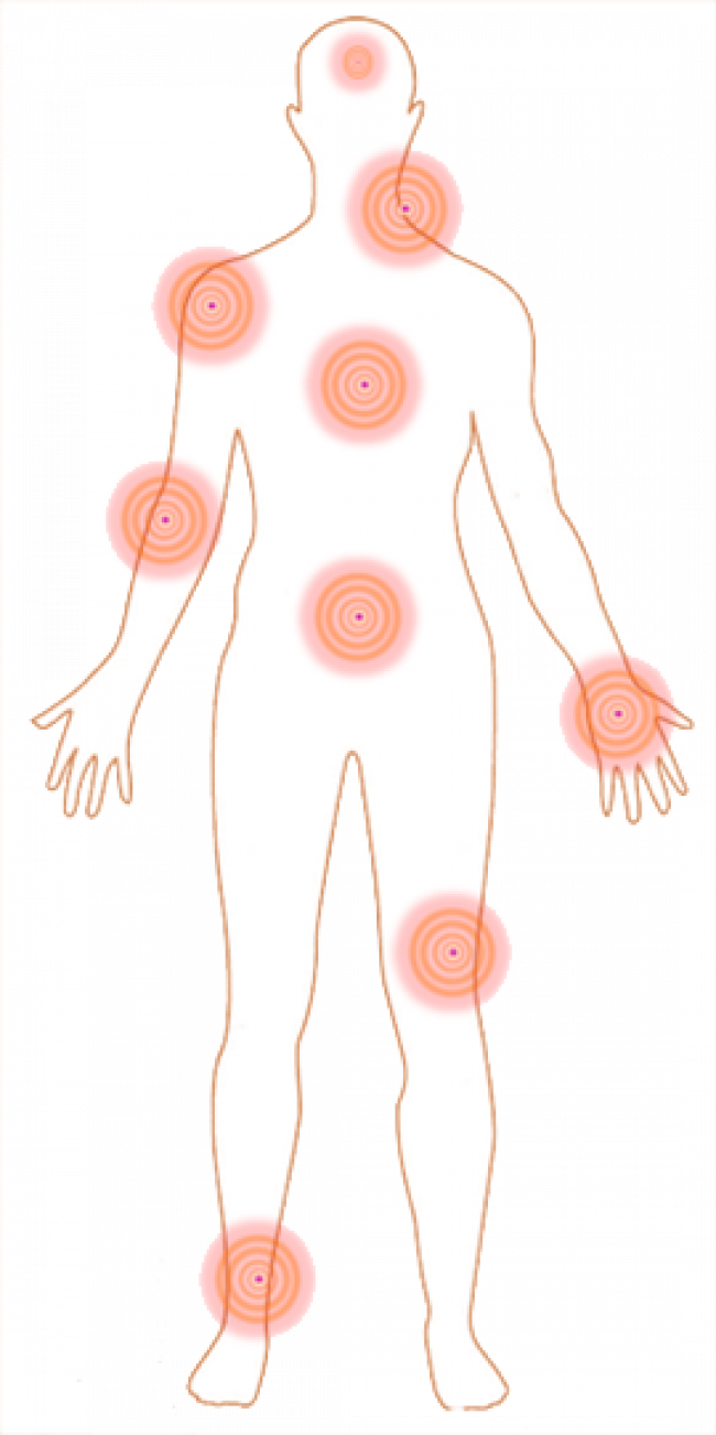 Akute vs. chronische Entzündungen