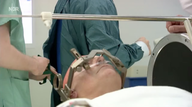 Operation am offenen Gehirn unter Hypnose