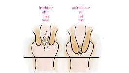 Kapitel 7 / Der Muttermund