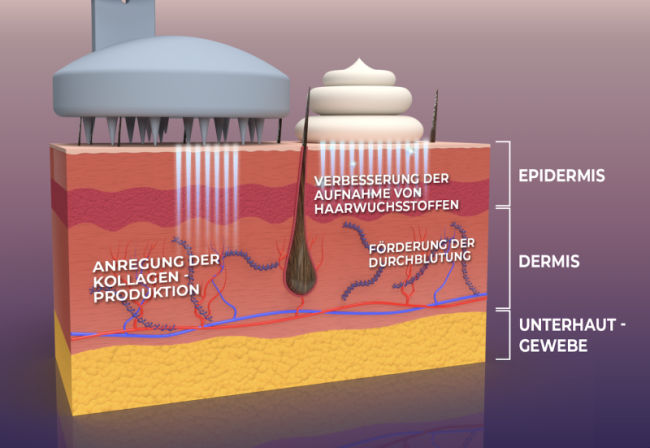 Die Wirkung unserer Kopfhaut Masssagebürste