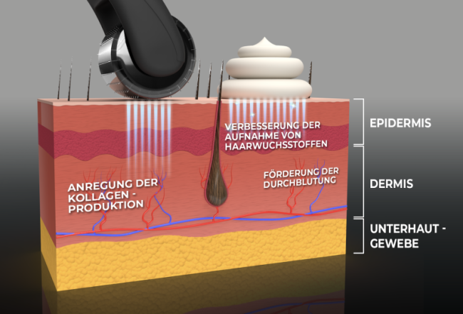 Die Wirkung unseres Bartrollers