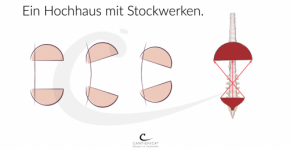 ​Tag 2 Horizontal stabilisieren, diagonal mobilisieren
