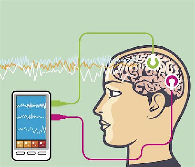 10.2 Welche Formen von Neurofeedback gibt es?