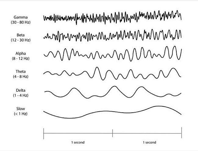 10.4 Der praktische Ablauf einer Neurofeedback-Sitzung