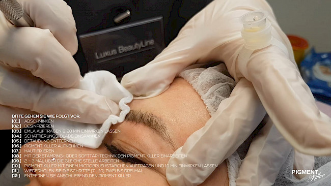 Schulungsvideo - Pigment Killer mit Blade