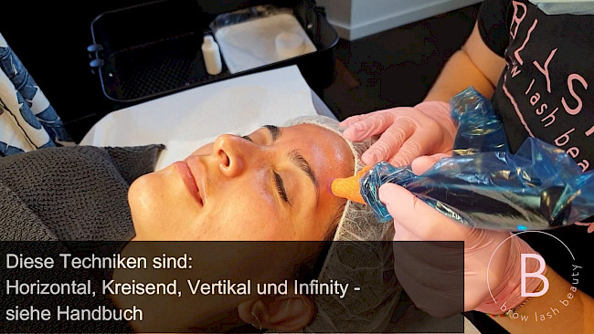 Lektion 5 - Das Microneedling