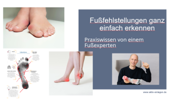 Woche 1: Fußfehlstellungen ganz einfach erkennen