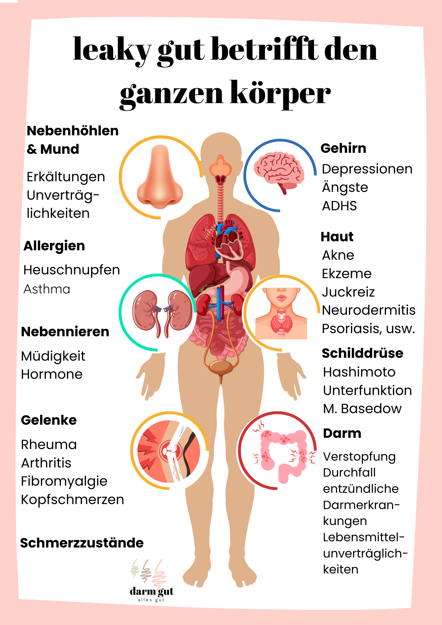 a4_leakygut_ganzerkoerper.1728121355.png