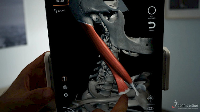 Woche 12 - Musculus sternocleidomastoideus