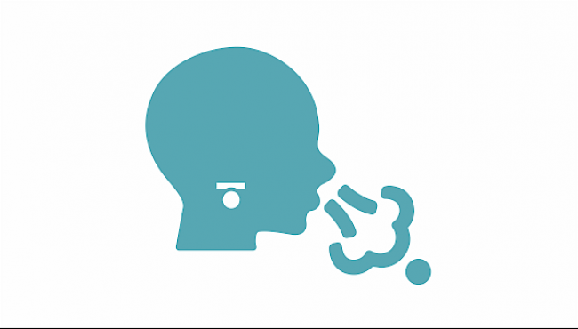 Heimlich und Co: Oberbauchkompression oder Thoraxkompression