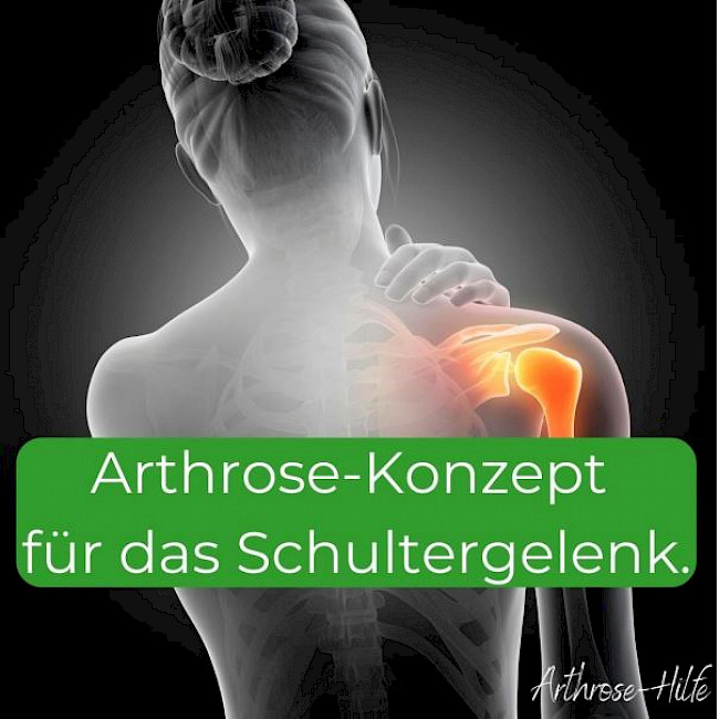 Arthrose-Konzept für das Schultergelenk