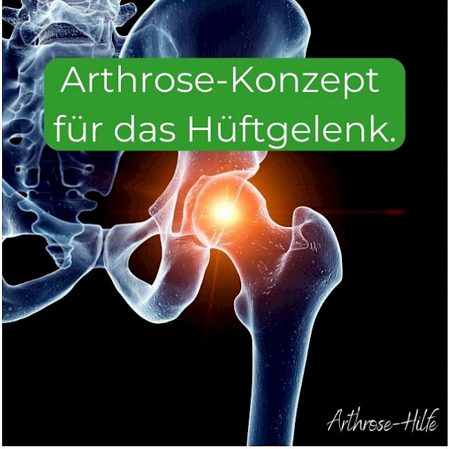 Arthrose-Konzept für das Hüftgelenk