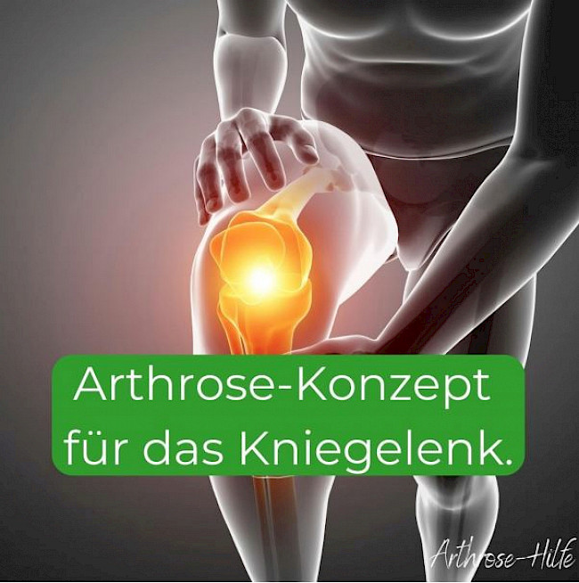 Arthrose-Konzept für das Kniegelenk