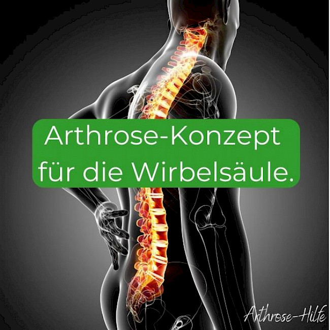 Arthrose-Konzept für die Wirbelsäule